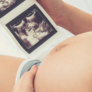 Pregnant woman holding a baby scan image
